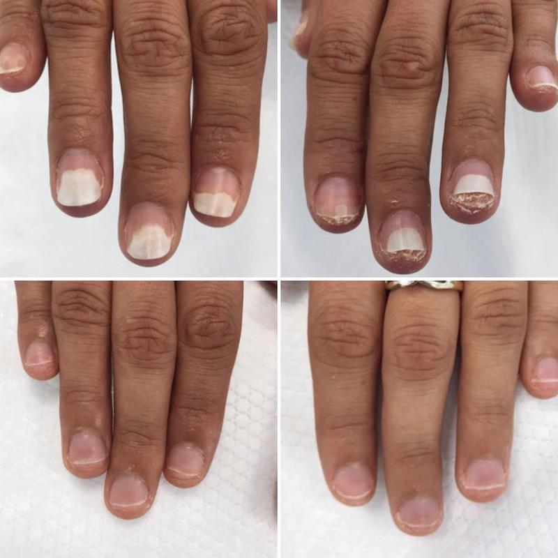 Porady ekspertów: jak wspierać wzrost paznokci