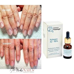 Czy paznokieć zawsze odrasta? Odkryj tajemnice ich regeneracji