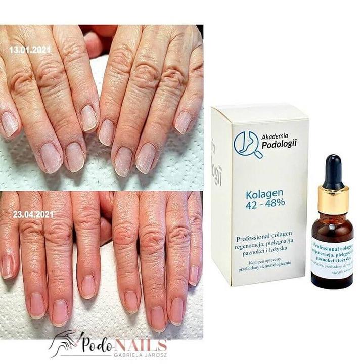 Czy paznokieć zawsze odrasta? Odkryj tajemnice ich regeneracji